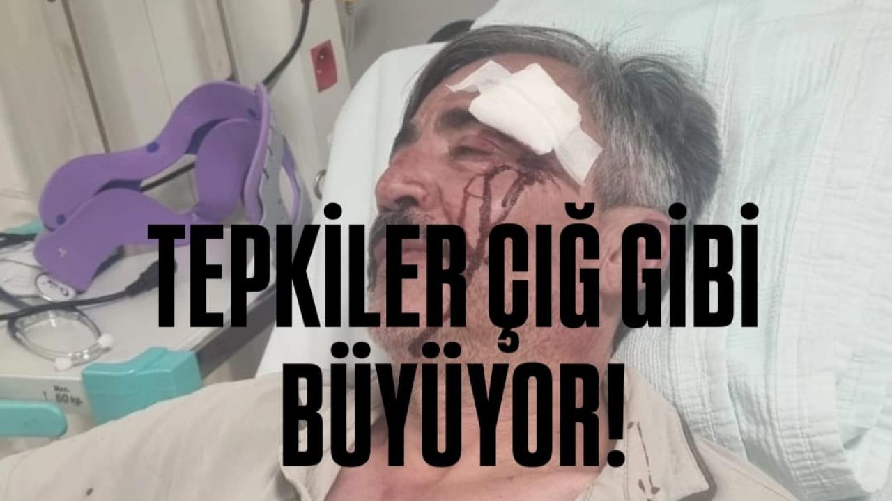 Tepkiler çığ gibi büyüyor!